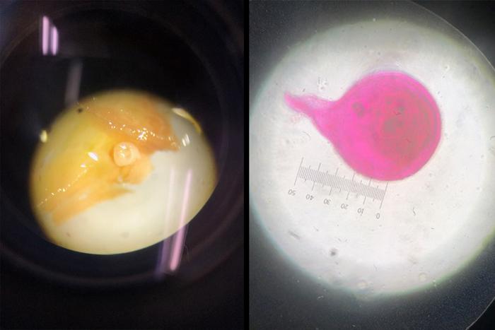 A female nematode