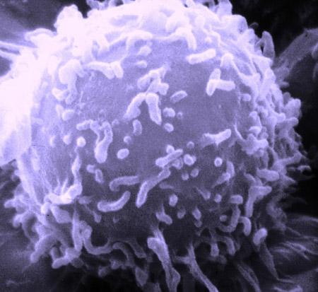 B Lymphocyte