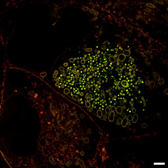 Expansion Microscopy (ExM)