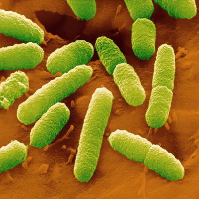 <I>E. coli</I>