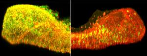 Gonadotrophs in pituitary gland
