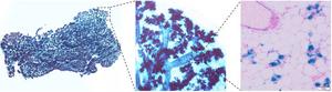 Morphology of a mouse mammary gland after labeling to detect senescent cells (in blue).