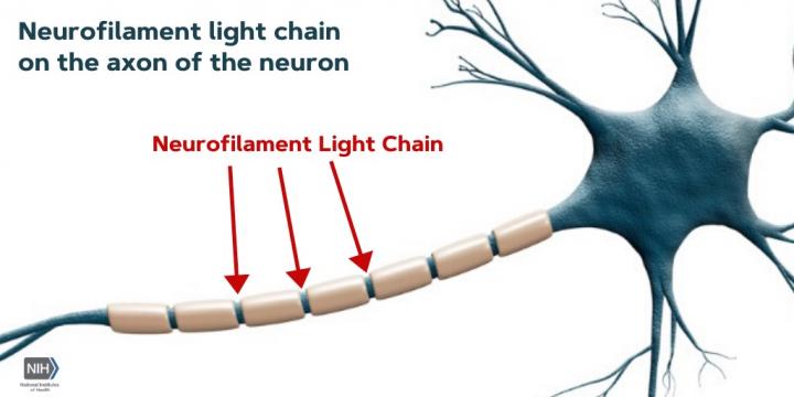 Neurofilament Light Chain on the Neuron