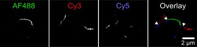 How Do Protein Tangles Get so Long in Alzheimer's?