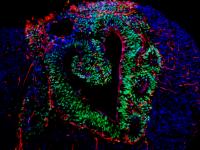 Brain Organoid