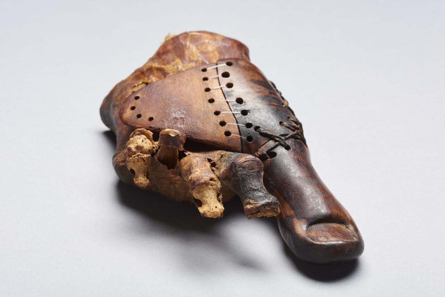 Toe Prosthesis