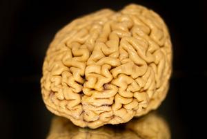 A donated SuperAger brain