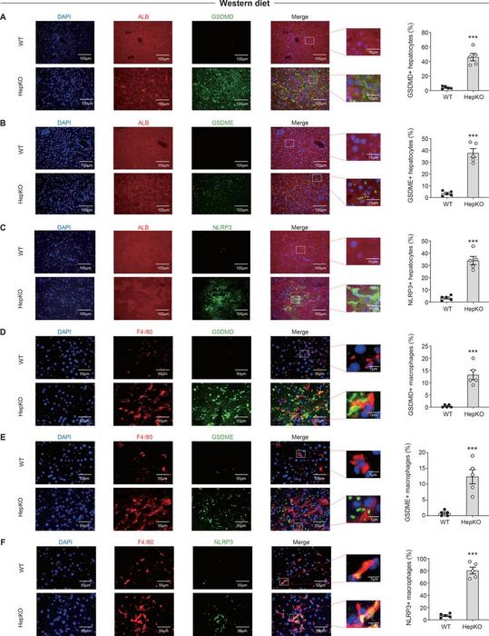 Pyroptosis occurs primarily in hepatocytes and inflammasomes are formed predominantly in macrophages in the liver of Atg14 HepKO mice.