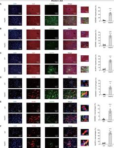Pyroptosis occurs primarily in hepatocytes and inflammasomes are formed predominantly in macrophages in the liver of Atg14 HepKO mice.