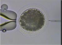 ICSI Procedure