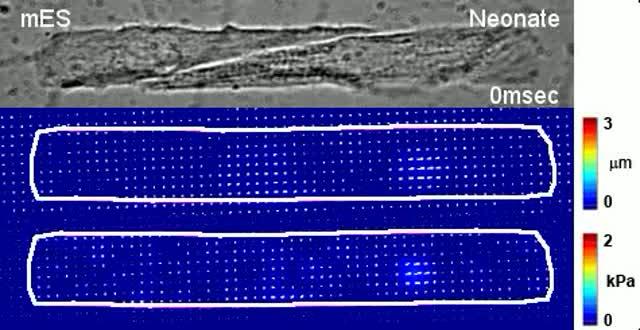 Muscle On-a-Chip Models Cardiac Stem Cell Therapy