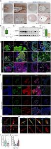 The expression of WIPF1 in the early maternal-fetal interface of humans or mice with recurrent spontaneous abortion (RSA) and their respective controls.