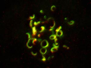 Microscopy image of kinetochore coronas (green) during cell division.
