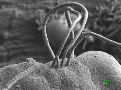 Segmented Filamentous Bacterium (SFB) Colony