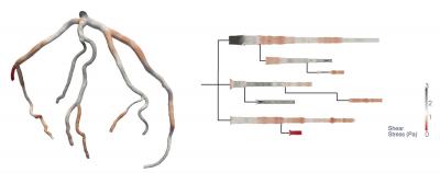 Comparison of 3-D and 2-D Visualizations