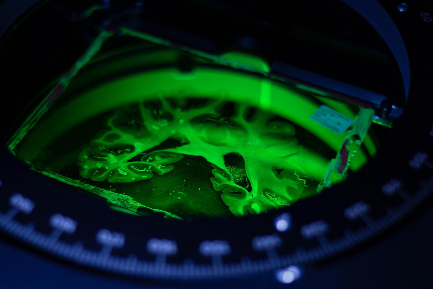 High Resolution Brain Imaging