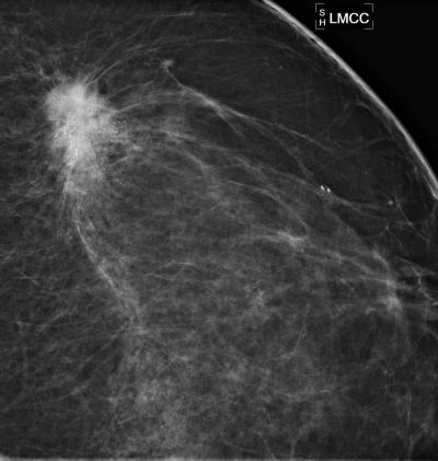 Spot Magnification