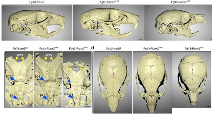 Exploring the impact of RUNX2 deficiency in skull development of mice
