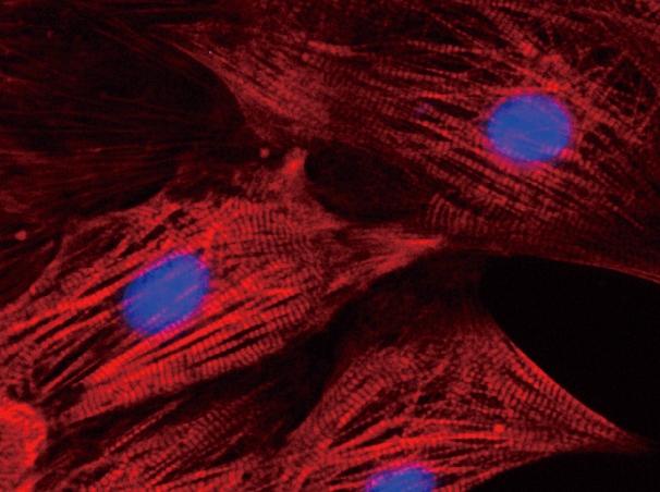 Skin Cells Were Reprogrammed Into iPS Cells, Which Were Then Differentiated Into Heart Cells