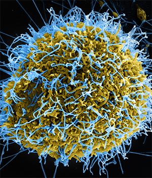 New Test Detects All Viruses that Infect People, Animals