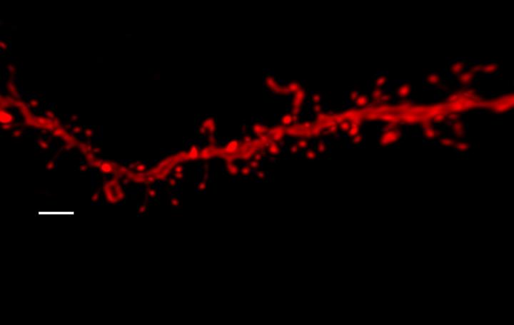Dendritic Spines