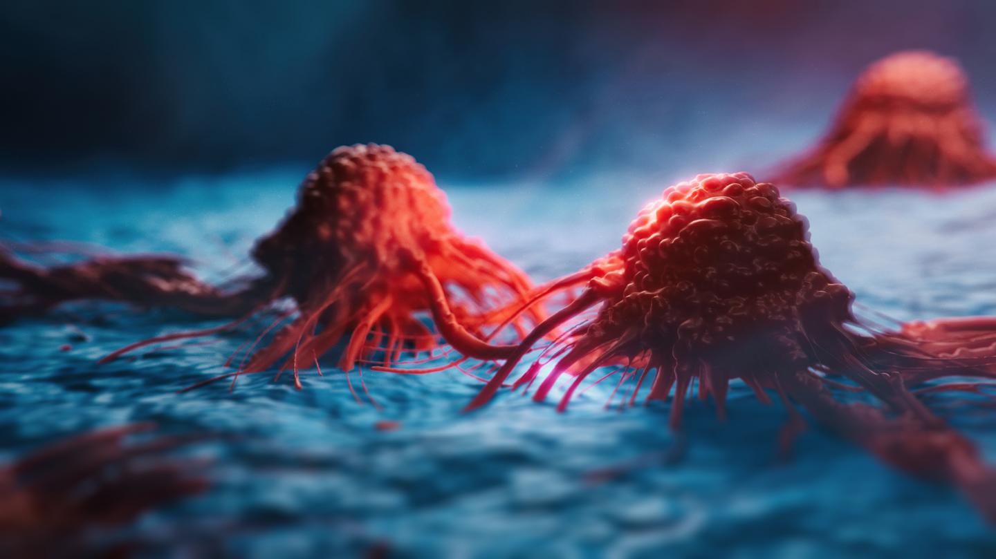 Ovarian cancer cells