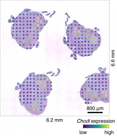 CHODL Expression