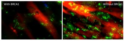 BRCA1 Plays a Critical Role in the Normal Metabolic Function of Skeletal Muscle