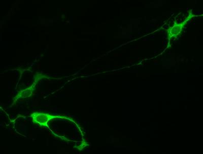 Reprogramming Brain Cells