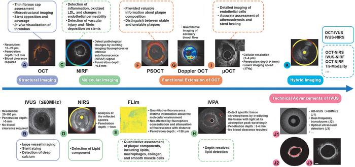 Figure 1Open multimedia modalEvolution and clinical applications of intravascular imaging technologies