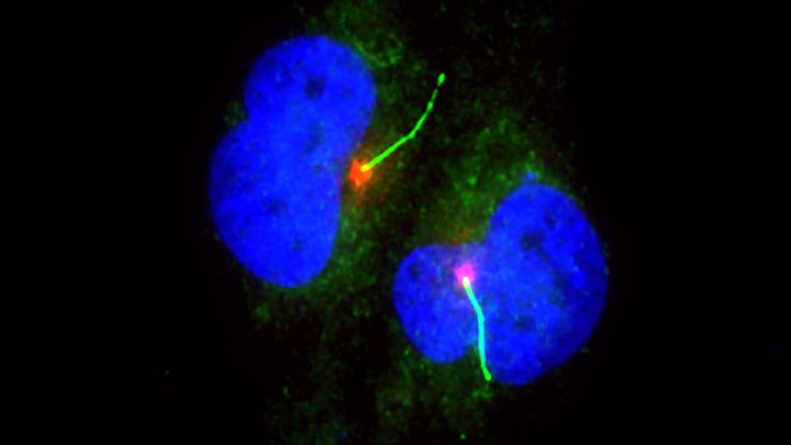 Ciliated Pigment Cells
