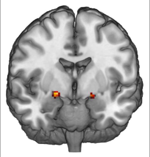 Huettel Functional MRI