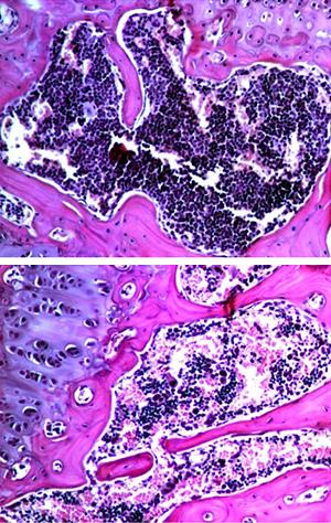 Bone Marrow in Mice with Suppressed Ether Lipid Production
