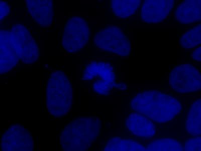 Aneuploidy -- Causes and Consequences (1 of 9)