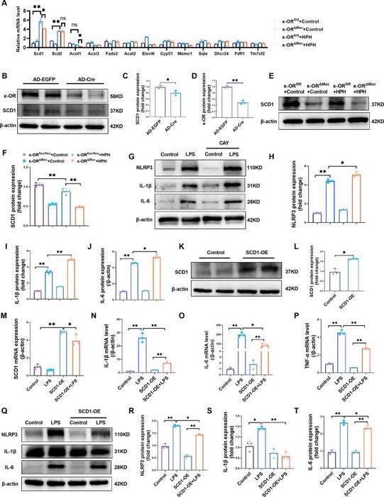 κ-OR activation exerted an anti-inflammatory effect on macrophages via the up-regulation of SCD1.