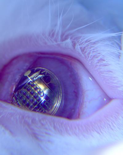 Contact Lens (2 of 2)