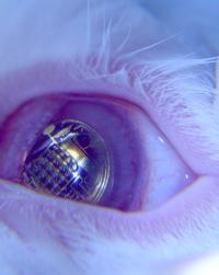 Contact Lens (2 of 2)