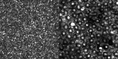 Cones and Rods in the Retina