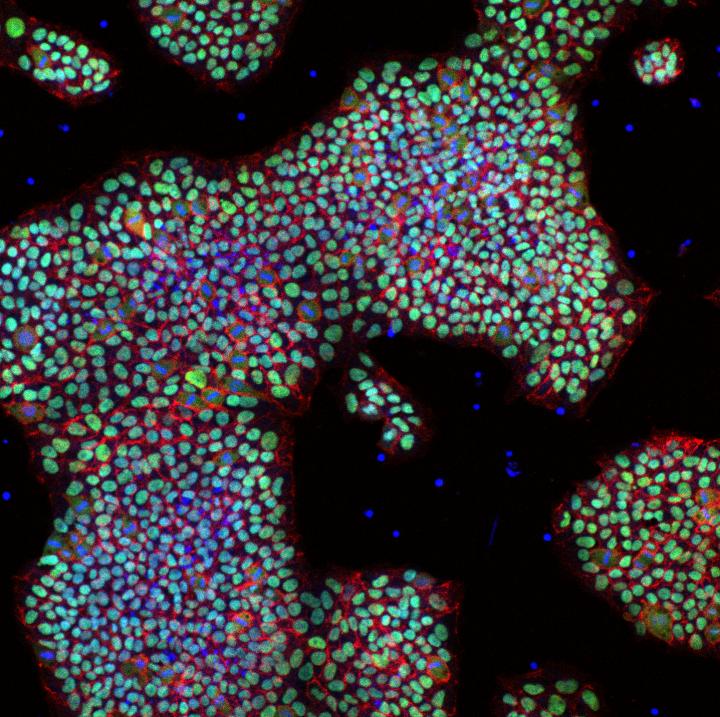 Stem Cells