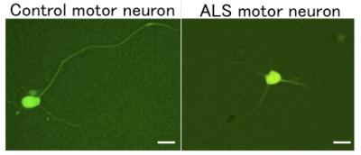 iPSC-motor Neurons