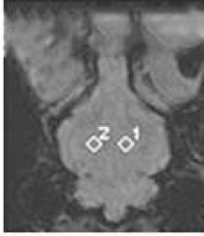 Rabbit Thalamus