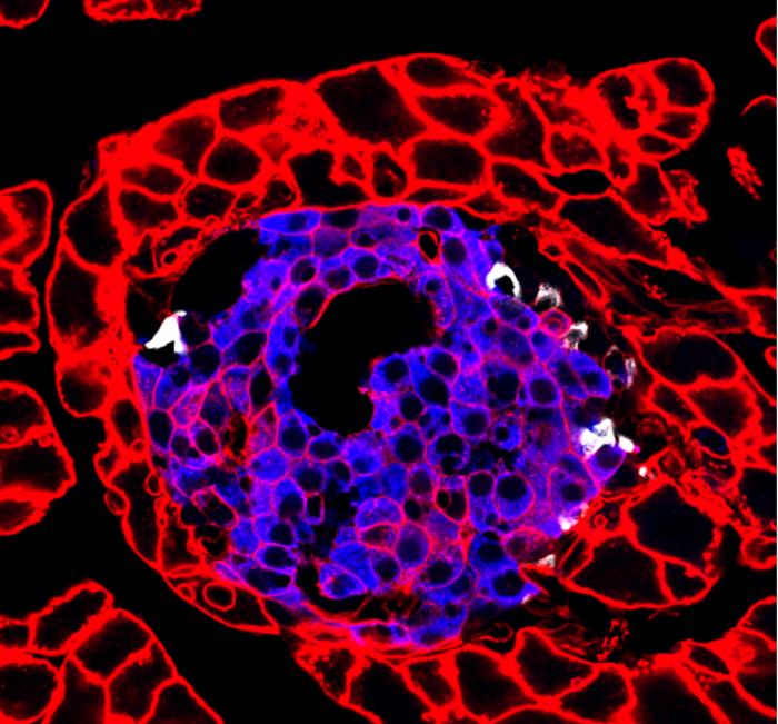 Newly Recognized Pathway Could Protect Diabetics from Hypoglycemia