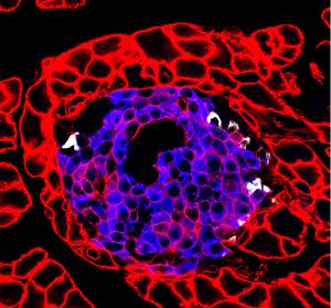 Newly Recognized Pathway Could Protect Diabetics from Hypoglycemia