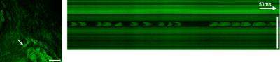 Label-free Tissue Imaging With SRS Microscopy