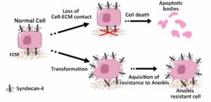 Researchers find potential therapeutic target against cancer