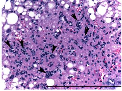 Damaged Liver