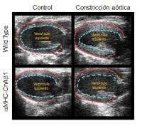Figure Overexpression of CnA&beta;1 in Cardiomyocytes Reduces Ventricular Hypertrophy