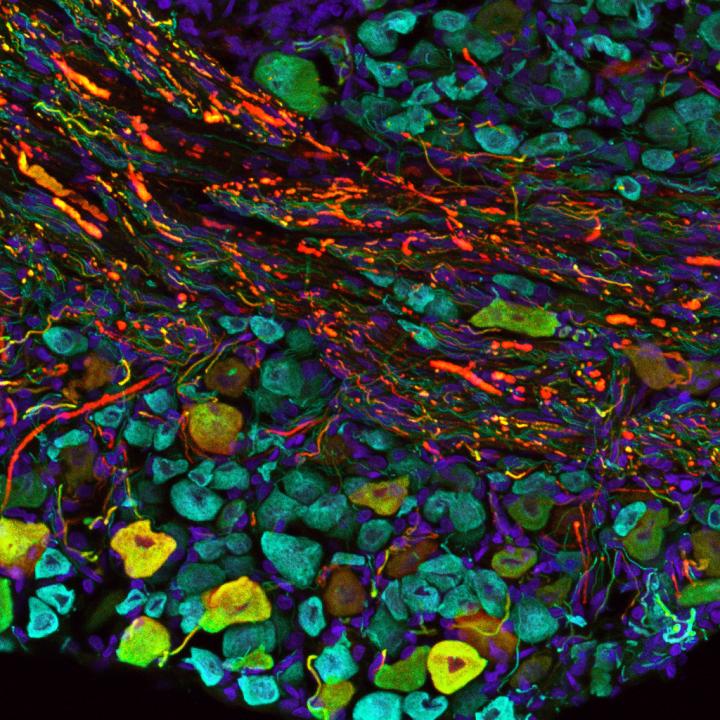 Bat Sensory Neurons