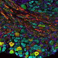 Bat Sensory Neurons
