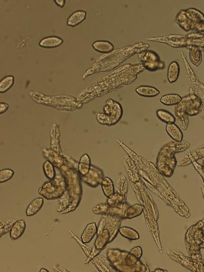 The Bdelloid Rotifer A. vaga